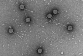 batteriofagi al microscopio elettronico