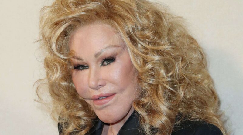 Jocelyn Wildenstein, figure de la jet-set, surnommée la « femme chat », est morte à Paris