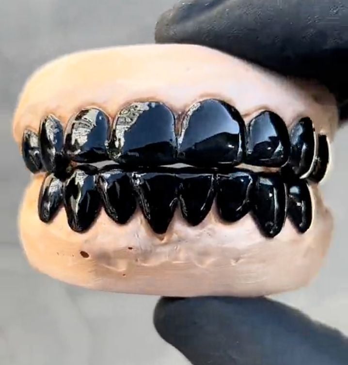 Accesoire amovible dentaire noir, grillz de GSM Custom Grillz