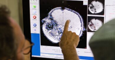 Développement du cerveau : âges clés à 9, 32, 66 et 83 ans