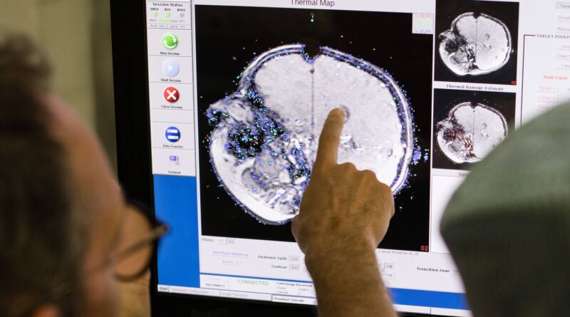 Développement du cerveau : âges clés à 9, 32, 66 et 83 ans