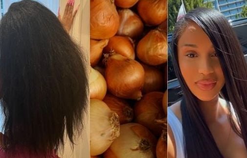 La recette de grand-mère de Cardi B à base d'oignon est-elle efficace pour les cheveux ?