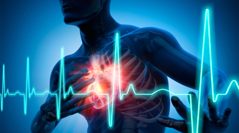 Crise cardiaque : nécessité d'une prise en charge immédiate aux urgences
