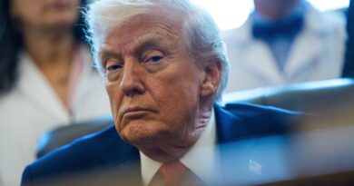 Etats-Unis : Trump dévoile la cause de ses hématomes récurrents