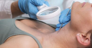 Grève des médecins : six mois d’attente pour un dermato, inquiétude sur la pénurie.