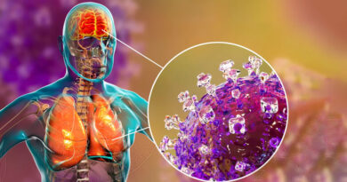 Inde : 5 cas de virus Nipah, 100 personnes en quarantaine.