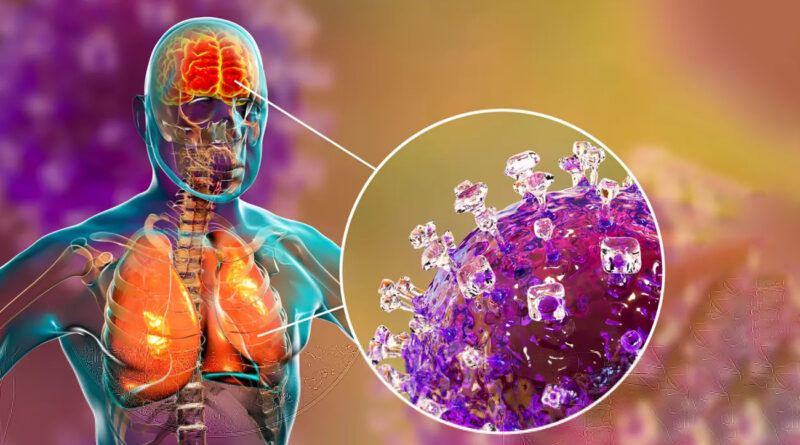 Inde : 5 cas de virus Nipah, 100 personnes en quarantaine.