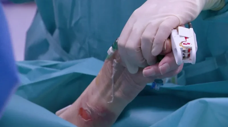 Immersion dans l'unité des grands brûlés du Grand Hôpital de Charleroi : un service difficile.