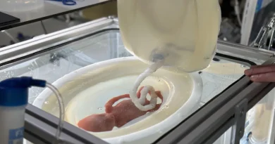 Un utérus artificiel pour grands prématurés : ce n'est plus de la science-fiction.