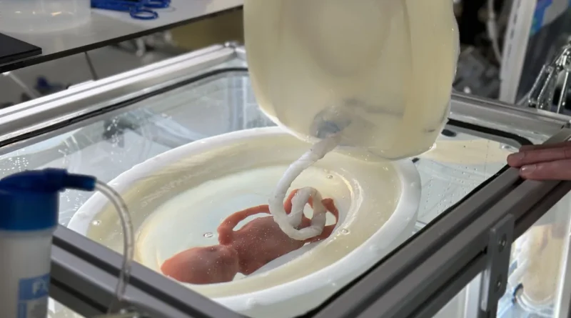 Un utérus artificiel pour grands prématurés : ce n'est plus de la science-fiction.