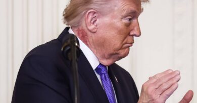 États-Unis : La santé de Trump mise en question après les hématomes