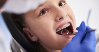 Les coûts des soins orthodontiques ne cessent d'augmenter, alerte Solidaris.