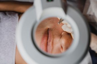 Injection esthétique illégale : un médecin souligne le danger après la mort d'une femme à Villeurbanne