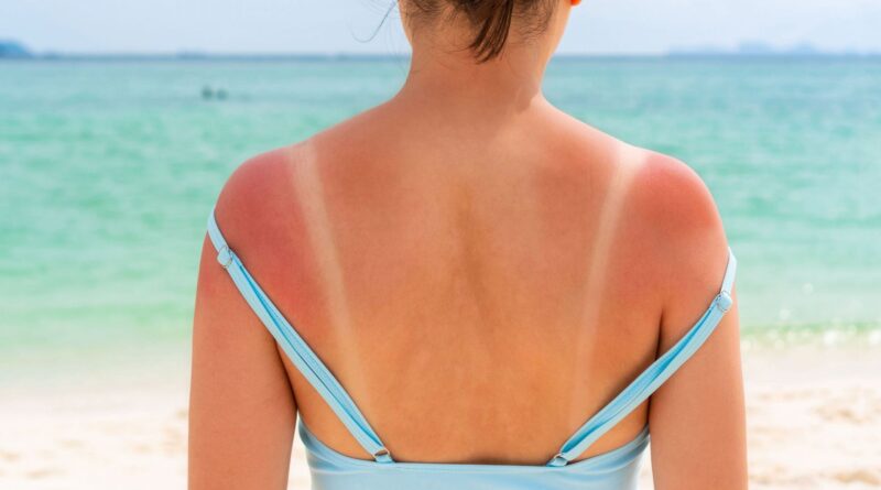 Les jeunes mal informés sur les dangers du soleil et la crème solaire