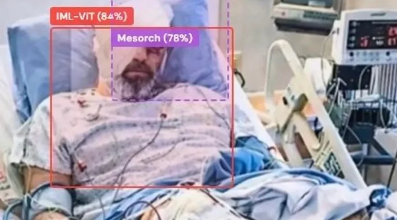 L'image de l'ayatollah Mojtaba Khamenei sur un lit d'hôpital est fausse.