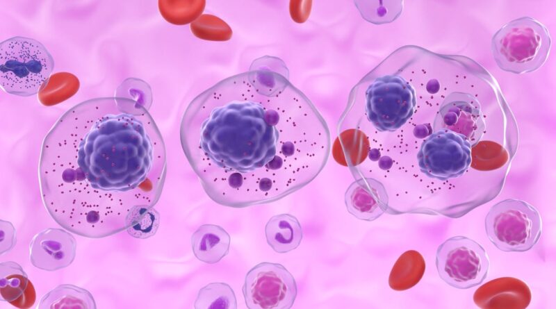 Norvège : Une greffe de moelle osseuse guérit du cancer et du sida