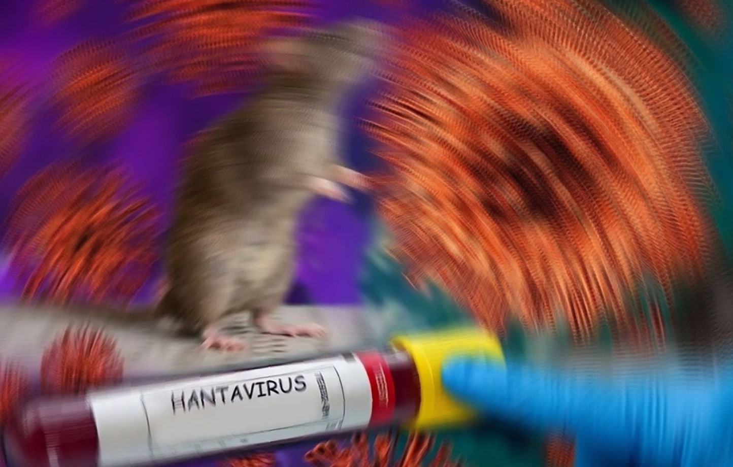 Hantavirus : Aucun cas d'infection confirmé aux Etats-Unis après tests