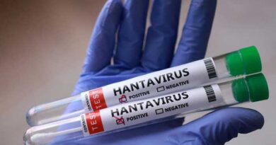 Hantavirus : Rester vigilant, ne pas céder à la psychose.