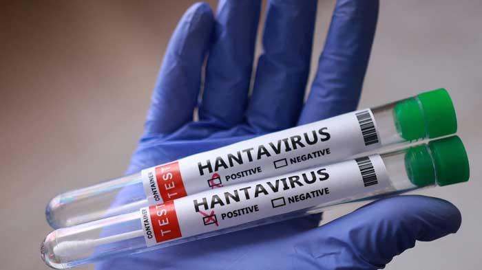 Hantavirus : Rester vigilant, ne pas céder à la psychose.