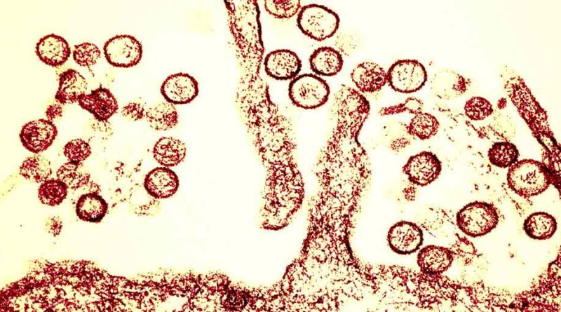Le hantavirus peut-il déclencher une nouvelle pandémie ? Précisions de l'OMS.