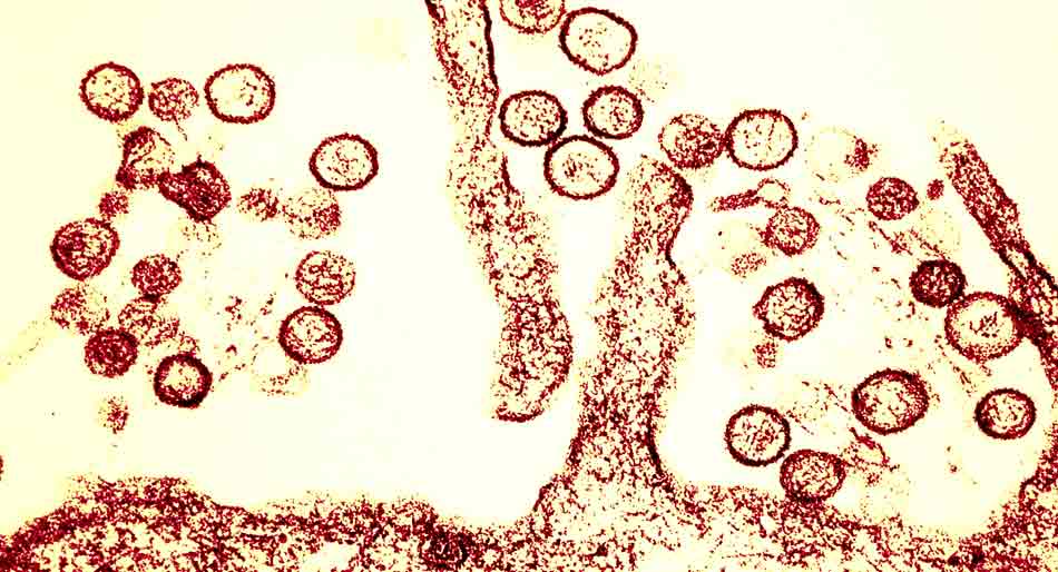 Le hantavirus peut-il déclencher une nouvelle pandémie ? Précisions de l'OMS.