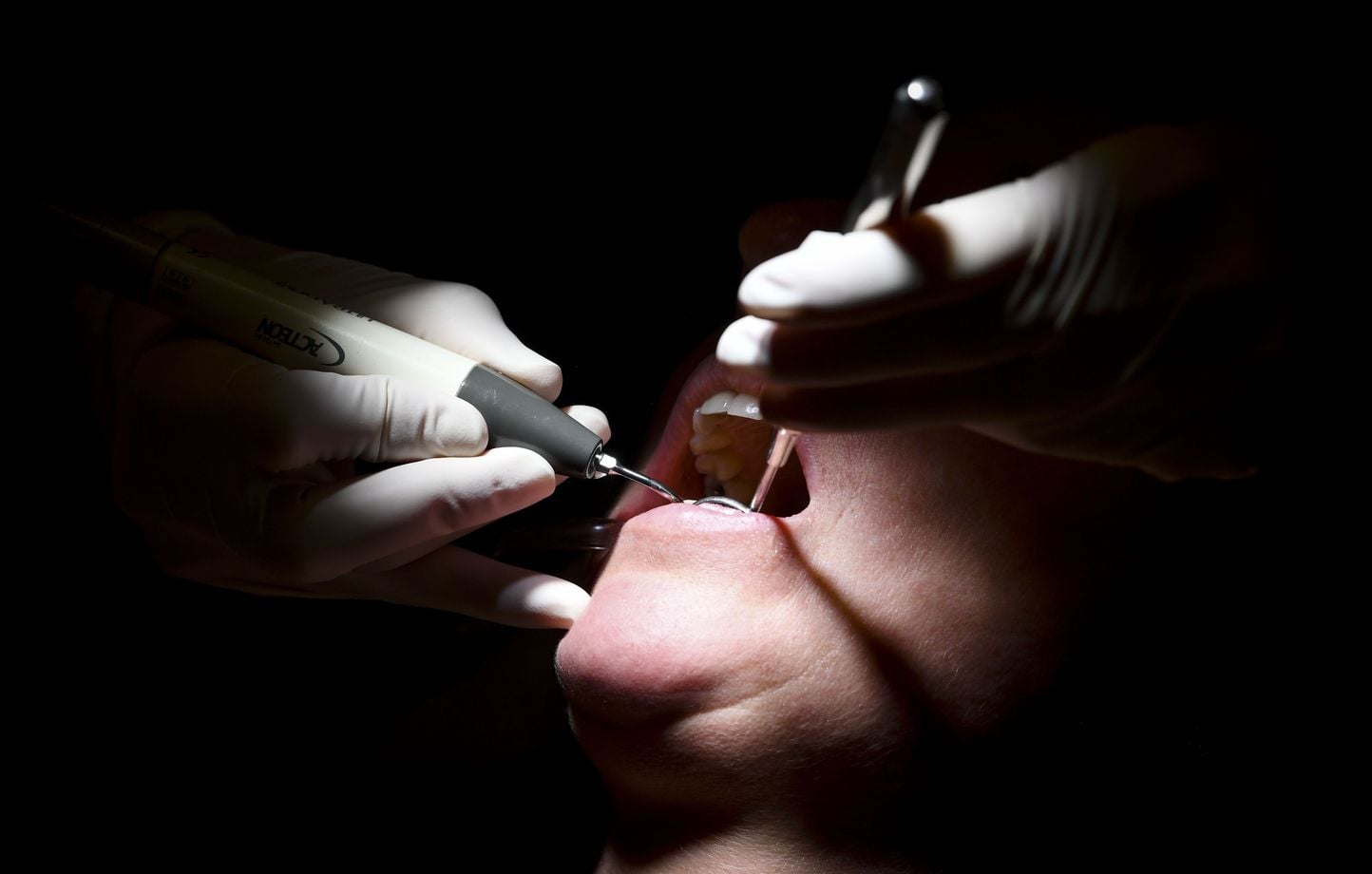 Lozère : Un ex-dentiste condamné pour mutilations, violences et escroquerie