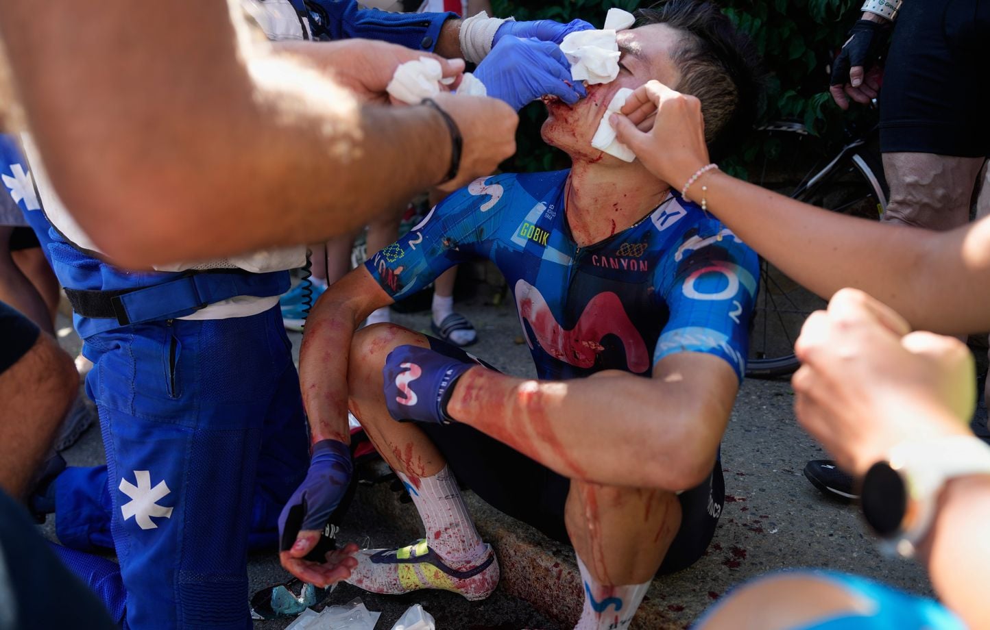 Tour de France 2026 : Rubio reçoit vingt points de suture après un accident à l'Alpe d'Huez