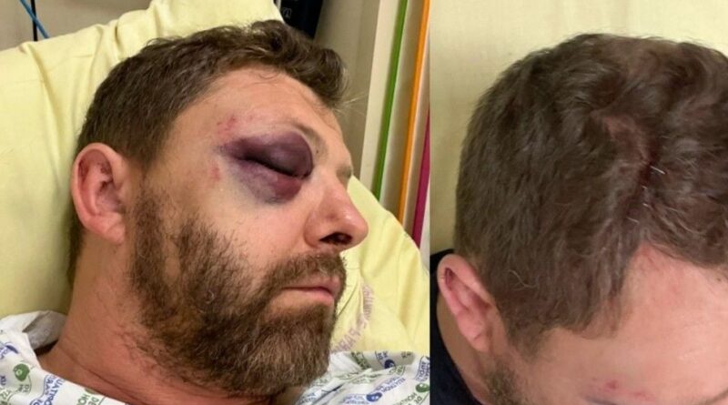 Homophobie : Un policier, président d’une association LGBT+, agressé à Paris
