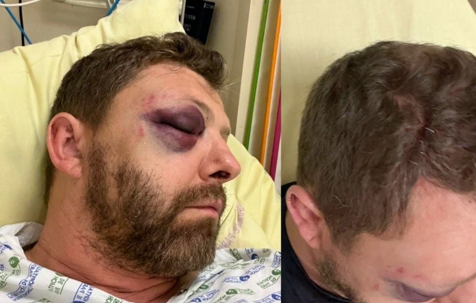 Homophobie : Un policier, président d’une association LGBT+, agressé à Paris