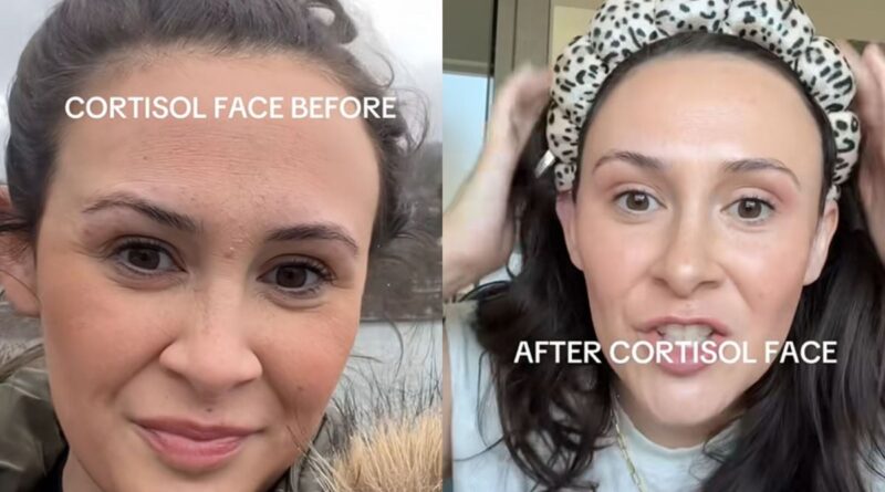Le « cortisol face » est-il une arnaque des réseaux sociaux
