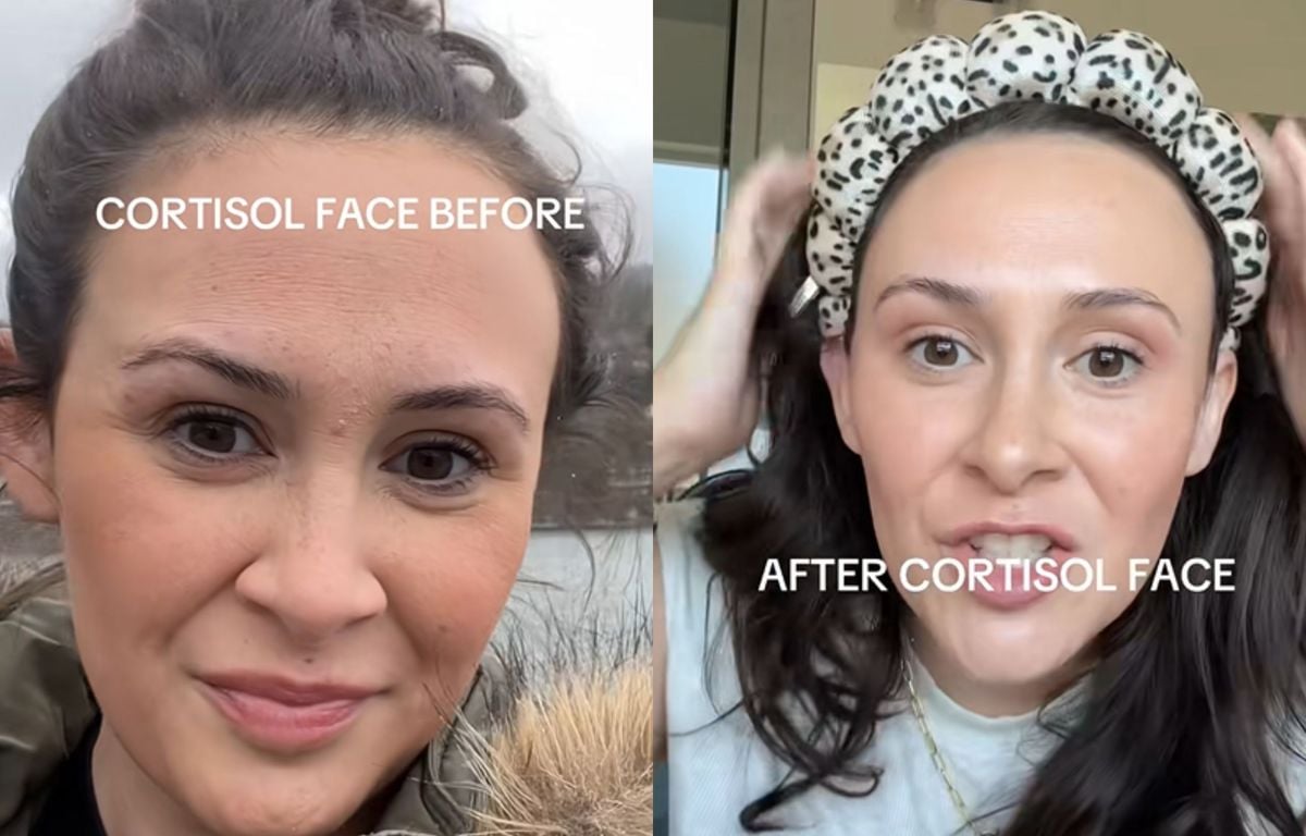 Le « cortisol face » est-il une arnaque des réseaux sociaux